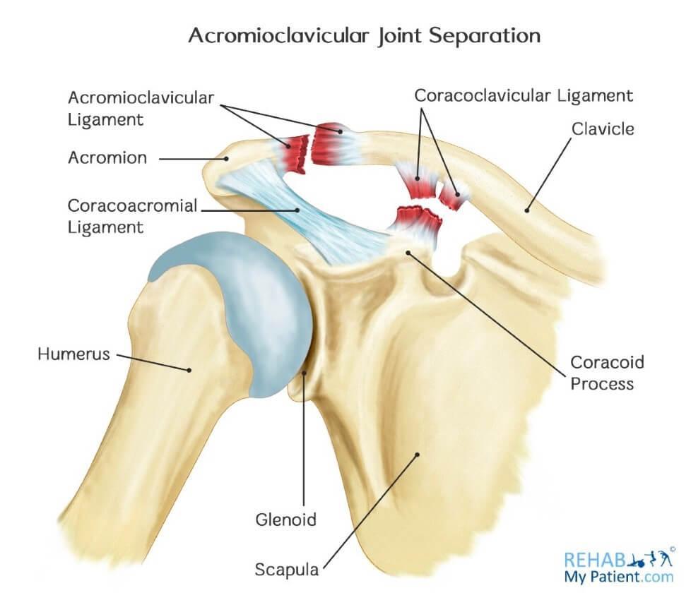 ligament Acromioclavicular ligament