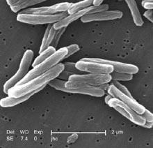Mycobacterium tuberculosis Ø small, aerobic, nonmotile bacteria Ø Gram-positive bacillus Ø can survive in