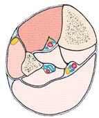 COMPARTMENTS Based on the fact that tumors spread along paths of least resistance Fascial or periosteal boundaries