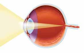 A Closer Look at Eyesight To understand how cataracts can affect your vision, it s important to know how your eye functions: 1.
