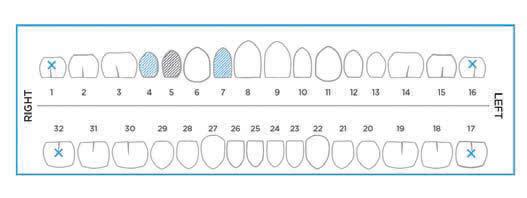 incisors TOOTH MOVEMENT ASSESSMENT The tooth movement assessment provides