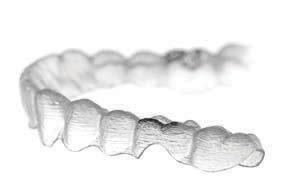 HOOKS FOR ELASTICS Mesial and distal hooks allow elastics to be used without buttons Available for buccal placements on canines, premolars and molars Based on aligner strength and durability tests 1