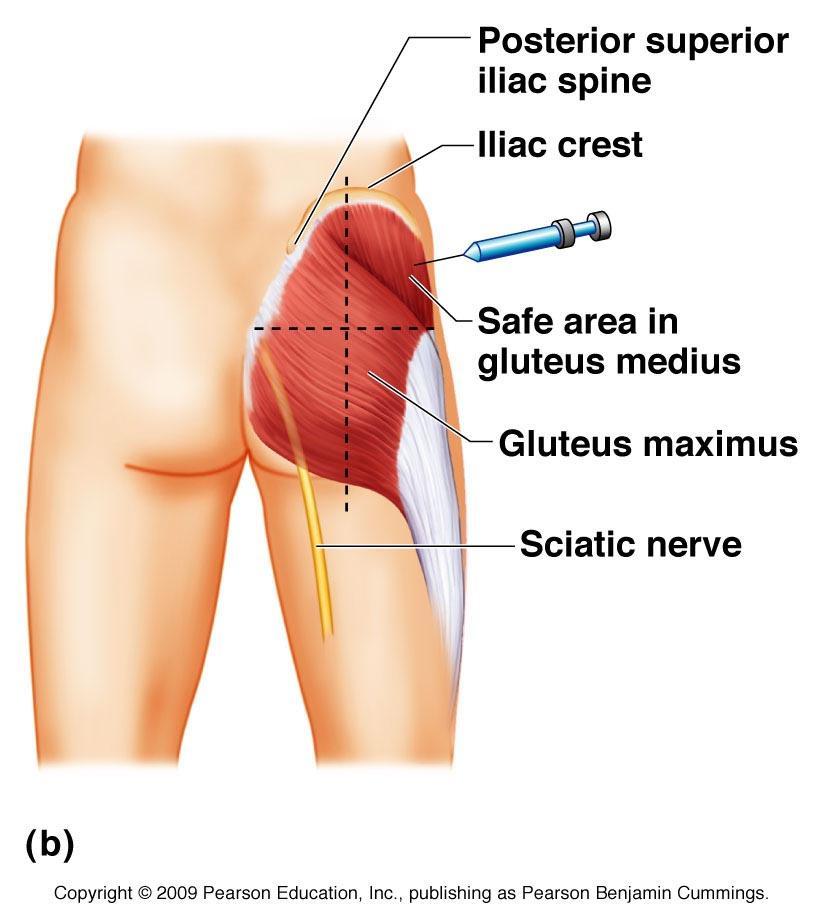 The Gluteal Region In the gluteal region the skin is tough with many layers underneath.