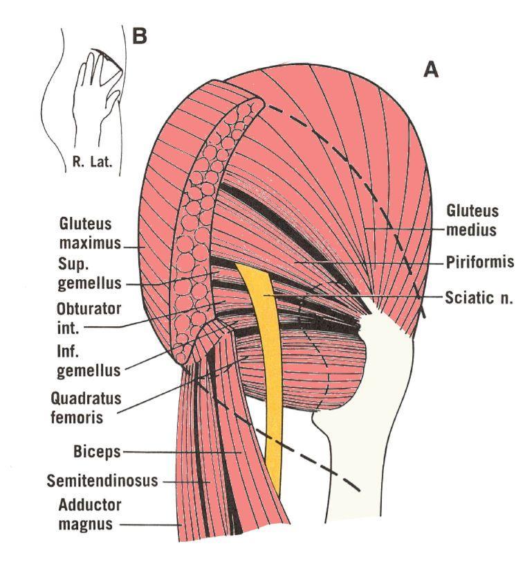 rotators are stronger than the medial rotators leading to forced lateral rotation