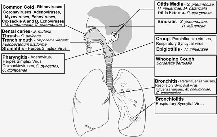 Upper Respiratory Tract Infections URI is a non-specific term that includes: Sinusitis Otitis media
