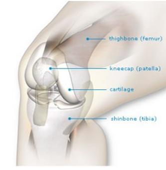 artificial parts. The procedure is performed by opening up the knee capsule and removing the ends of the thigh bone (femur), the shin bone (tibia), and the underside of the kneecap (patella).