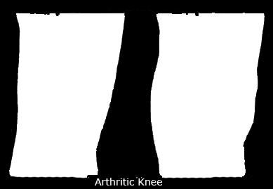 knee help to move the joint. Ligaments are equally vital because they are strong, tough bands that are not particularly flexible and stabilize the joint.