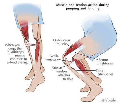 Knee Anatomy: Bones of the knee Knee joint capsule Ligaments of the