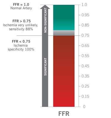 Incorporating FFR Measurement into Procedures Significantly Reduces Major Adverse Coronary Events When integrated into routine lab procedures, measurement of fractional flow reserve (FFR) has been