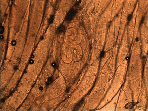 Figure 4. Trichinella larvae encysted in muscle tissue from wild boar ham roast (wet mount, magnification 40 ). the hunting and carcass-handling processes.