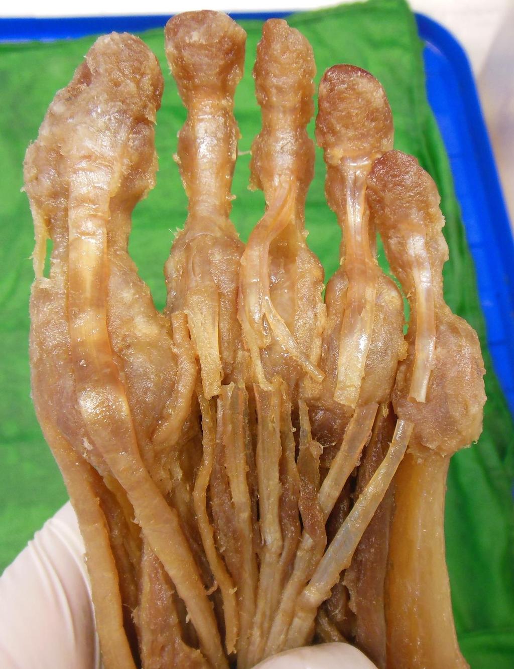Intertarsal joints: Amphyarthroses. Tarsometatarsal (Lisfranc s) joints: Amphyarthrosis. Lisfranc s amputation.