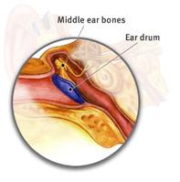 Middle Ear Cavity air-filled space behind the eardrum and houses three bones.