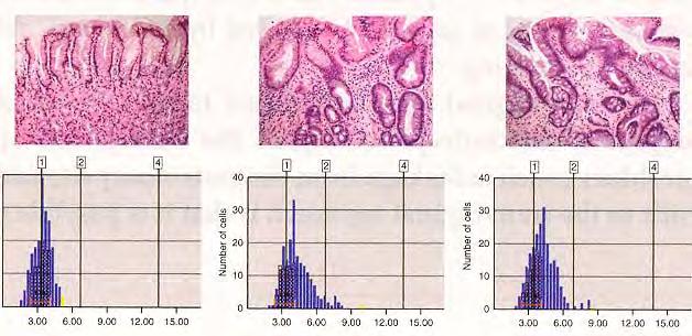 A study of endoscopically confirmed columnar epithelium in the distal esophagus by image analysis: mucosa with IM and