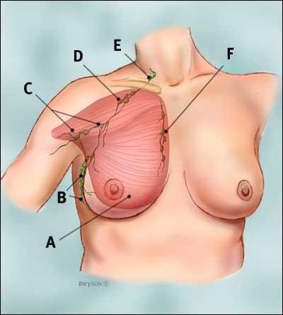 Page 2 Axillary Lymph Nodes The illustration below shows the major muscle and lymph nodes in and around the breast area. A. Pectoralis major muscle B. Axillary lymph nodes: levels I C.