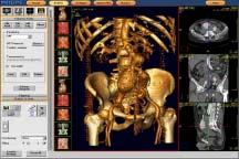4 1 mln Diagnosis of anatomy, all body parts