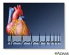 Biology 13A Lab #10: Cardiovascular System II ECG & Heart Disease Lab #10 Table of Contents: Expected Learning Outcomes...... 83 Introduction....... 84 Activity 1: Collecting ECG Data.