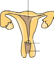 Uter Col uterin Vagin Screening-ul cancerului de col uterin urmareste sa determine prezenta sau absenta celulelor anormale aflate in stadii initiale, cand pot fi indepartate usor, inainte de a se