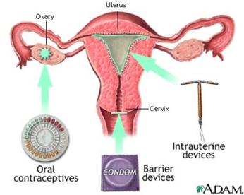 The following lesson on contraception (birth control) is not intended to infer that