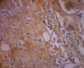 A B C D Figure 2. A. Immunohistochemestry image of group 1 with treatment water extract gold sea cucumber concentration 80%. B. Immunohistochemestry image of group 2 with treatment water extract gold sea cucumber concentration 40%.
