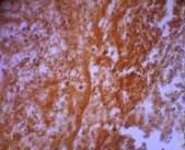 Immunohistochemestry image of group 4 with no treatment or negative control. Table 1.