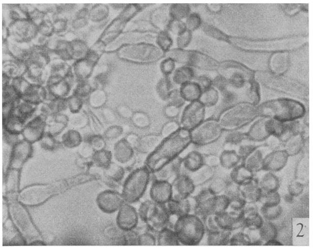 EFFECTS ON GROWTH AND-~ELANIN IN CLADOSPORIUM 309 Fig. 2. Appearance of Cladosporium mansoni grown for two weeks ill defined medium #2 in the light.