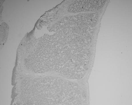 Basal membrane of the capillaries Endothelium of