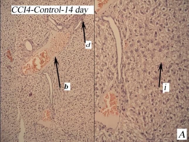 edges and multiplied HCC compensation calving (nucleus fragmentation) in the examining field within 7 days. Figure 6A showed histology in the control group in 14 days.