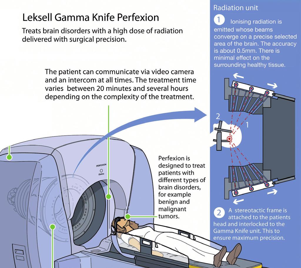 Treatment with Gamma Knife Radiosurgery Gamma Knife Radiosurgery is a well established method of treating pituitary tumours.