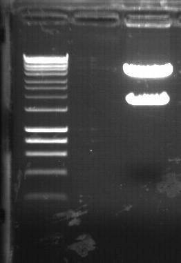 (A) PCR product of F5-TCRβ insert (950bp) (B)