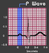 ECG Waves