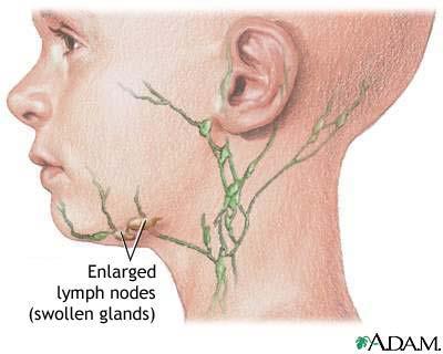 Lymph nodes Lymph nodes are filled with white blood cells.