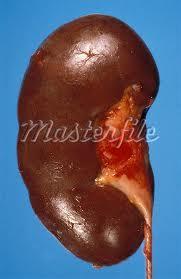Urinary System Parts and their Functions There are two beanshaped kidneys in the urinary system.