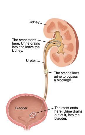 There are two ureters in the urinary system.