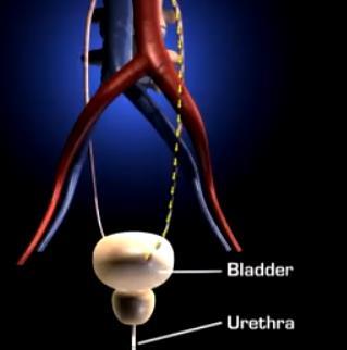 Urine passes into the urethra which is a tube located at the bottom of the bladder that leads to the