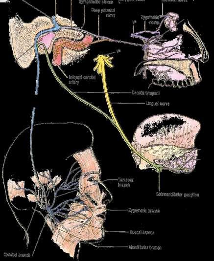 Facial nerve in the temporal bone and main branches and distribution Mixed (SVM, GVM, SVS) Pons internal