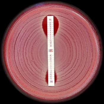 transferred to the agar matrix. After 18 hours incubation or longer, a symmetrical inhibition ellipse centered along the strip is formed.