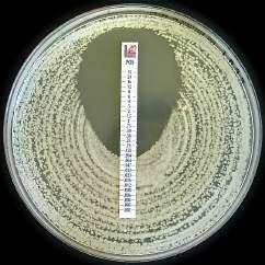 MUELLER HINTON AGAR II + 2% NaCl for antimicrobial susceptibility testing