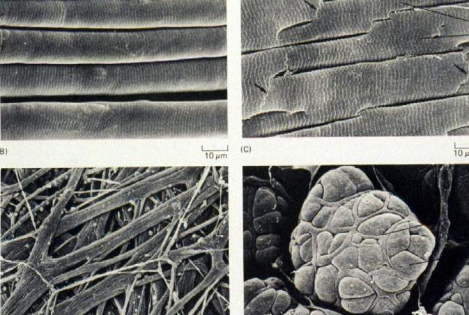 Objectives Identify smooth, skeletal, and cardiac muscle on route histological preparations Explain the morphological basis for