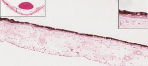 Dilator muscle of iris Myoepithelial cells Cardiac muscle short