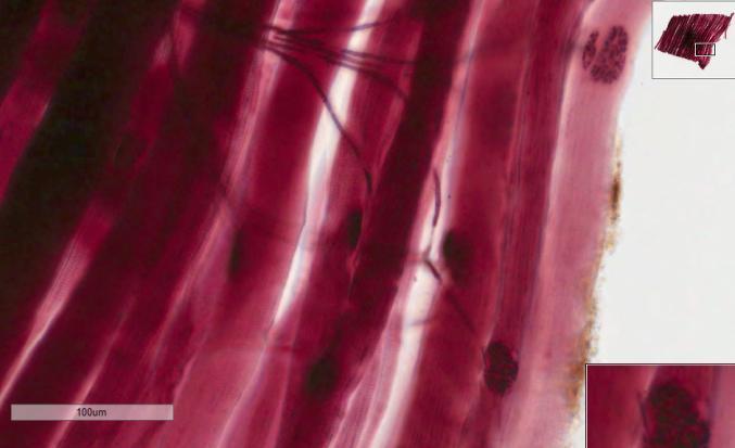 Slide HISTO007 skeletal muscle cells Nerve muscle interface at the