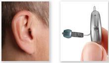 moderate hearing loss In-the-ear (ITE)