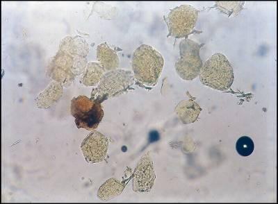 Parenchyma cells with fiber, rosette crystals, prismatic crystals(indrayava),