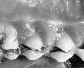Drug-influenced gingival diseases!