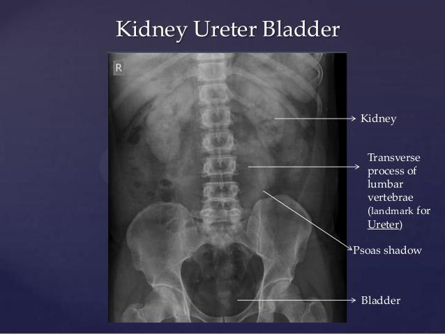 The bladder has variable appearance depending on how full it is.