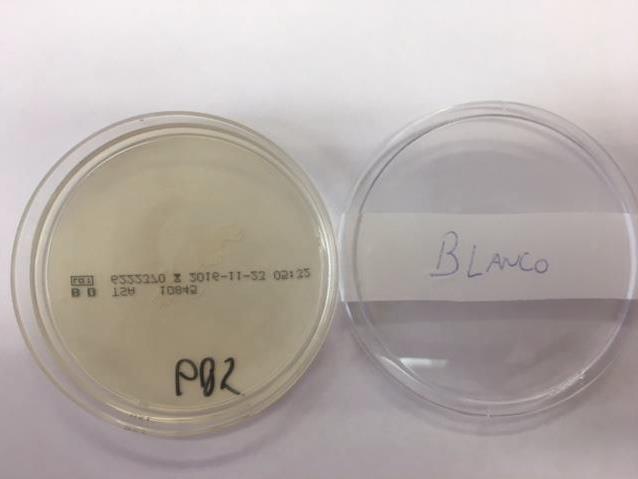 Agar plate pictures Batch