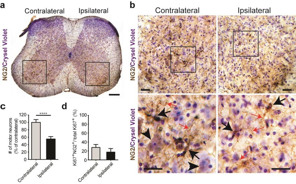 Supplementary Fig. 4 Ablation of spinal motor neurons does not induce reactive changes in NG2 + cells.