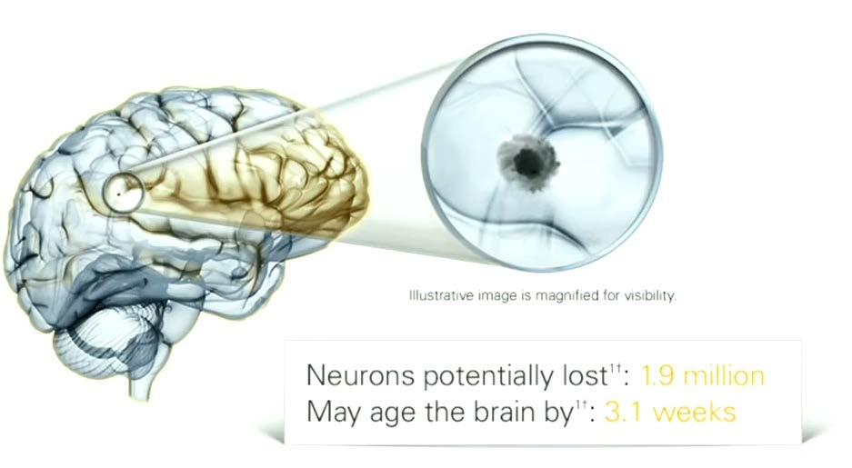 Each Minute Time Frame Neurons Lost Ages the brain by Every Second 32,000 8.