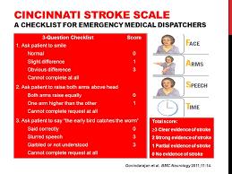 results 60% of stroke patients