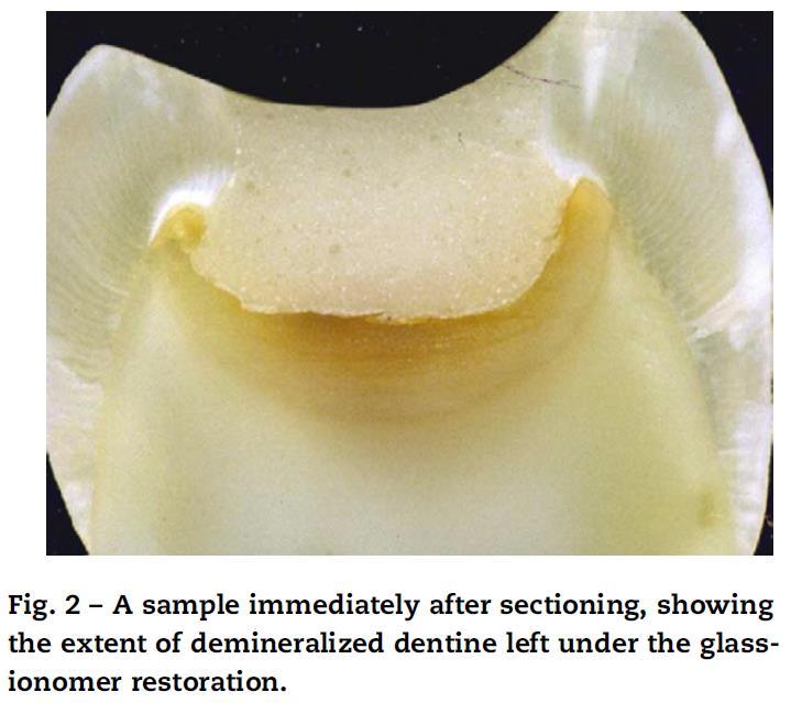 Chemical exchange between glass-ionomer