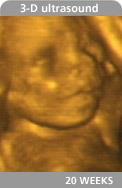 Month Fetus